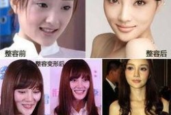 杭州整容爆料事件视频,揭秘美容行业潜规则与真实案例