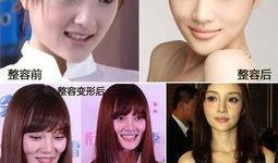 杭州整容爆料事件视频,揭秘美容行业潜规则与真实案例