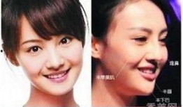 杭州整容爆料事件视频,揭秘美容行业潜规则与真实案例